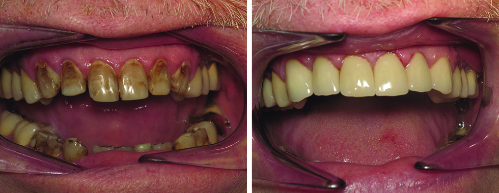 A major improvement!